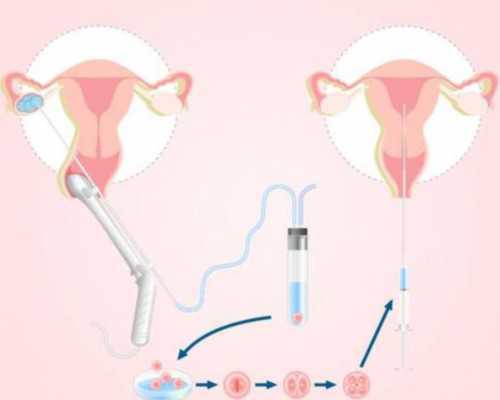 全国供卵私立医院有哪些,比大姨妈推迟更早知道女性怀孕的征兆是什么？