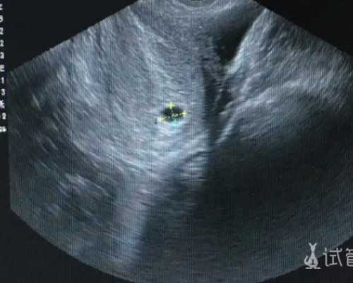 国内供卵代怀公司,没怀孕就去做试管婴儿真的有那么简单吗