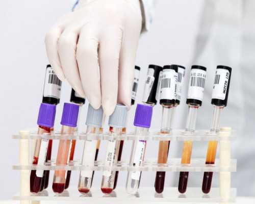 国内供卵代孕男孩全包,不适合做试管婴儿的人群(哪些人不适合做试管婴儿)