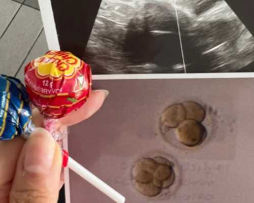 国内供卵试管做几代,试管婴儿男性前期准备什么试管婴儿各个环节需要多长时间