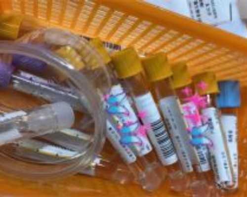 国内哪些医院供卵比较好,甲状腺功能异常对怀孕的影响大吗？不看真的不知道！