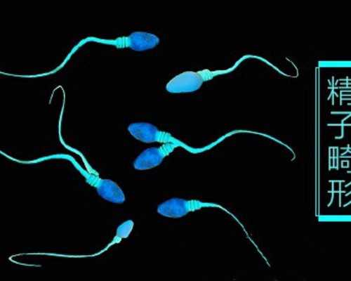 国内选择供卵试管的医院,试管婴儿取卵痛不痛(取卵后会卵巢早衰吗)